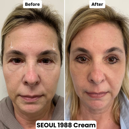 Seoul 1988 Eye Contour Cream
