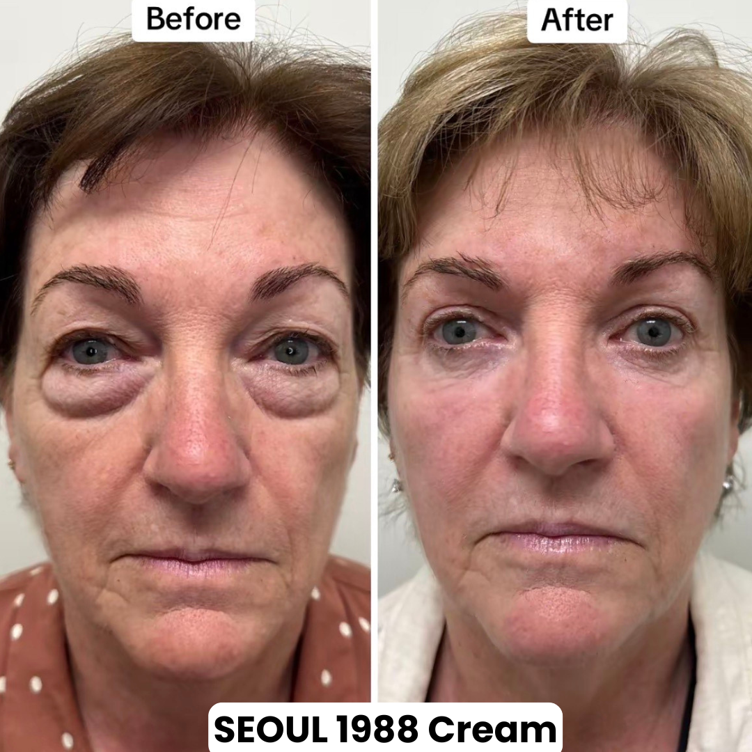 Seoul 1988 Eye Contour Cream